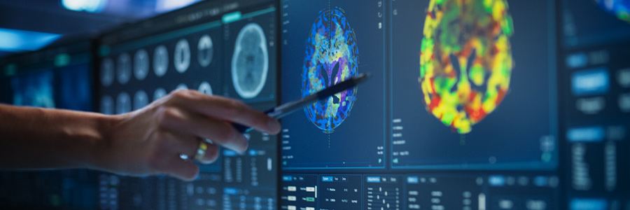 Multiple monitors display brain scans; a hand points at a highlighted area with a pen.